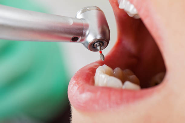 Best Emergency Treatment for Oral Infections in Jackson, AL